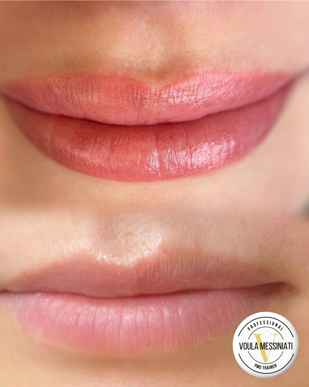 Voula_Messiniati_beforeandafter_lips Voula_Messiniati_beforeandafter_lips